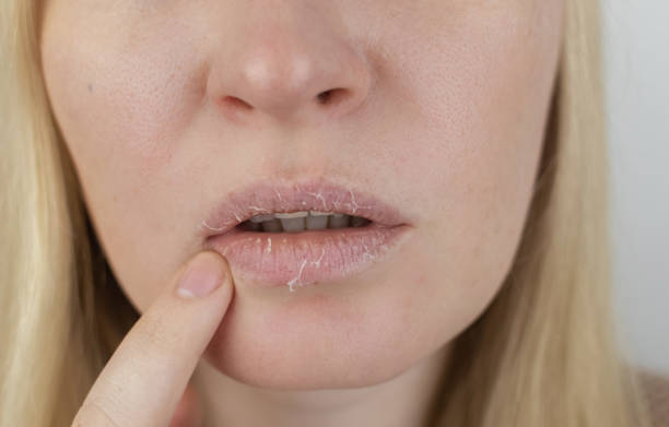 Natural Lip Balm Collection